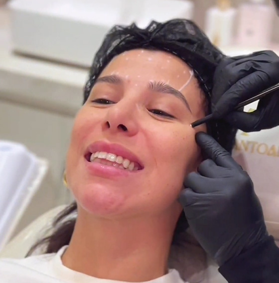 Procedimento estético facial conduzido com critério e precisão